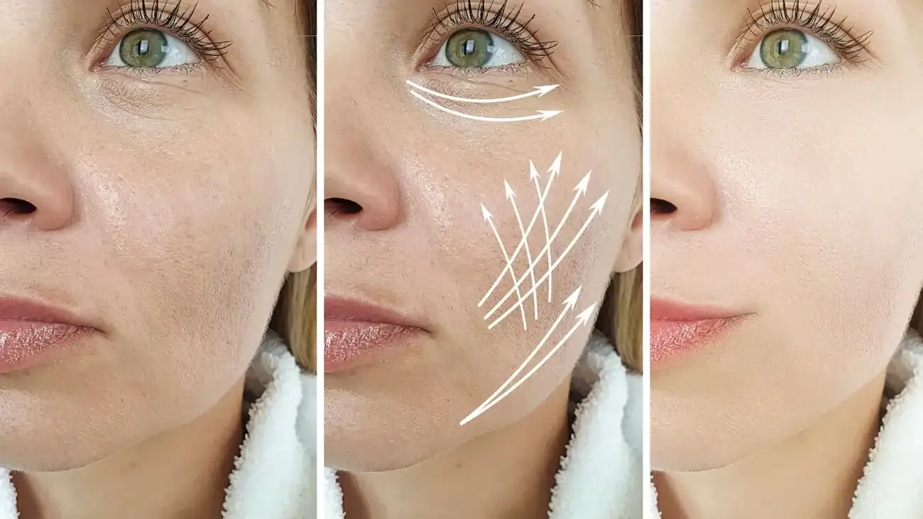 Can One Treatment Really Tackle More Than One Skin Concern Blackpool?
