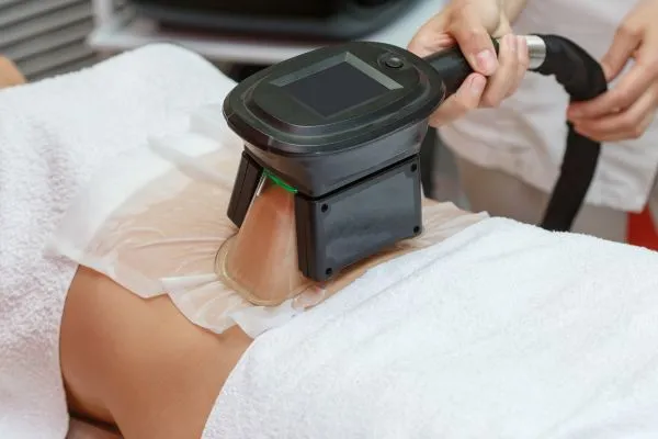 Image of person having fat freezing treatment to help weight gain Blackpool