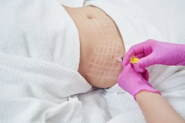 image of fat dissolving injections on love handles to help combat weight gain Blackpool