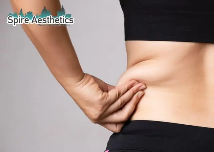 Image of woman pinching fat on their hips Blackpool. Fat Freezing treatment