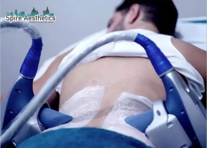 Man having fat freezing treatment done on love handles before a competitions Blackpool to create a sculpted look.