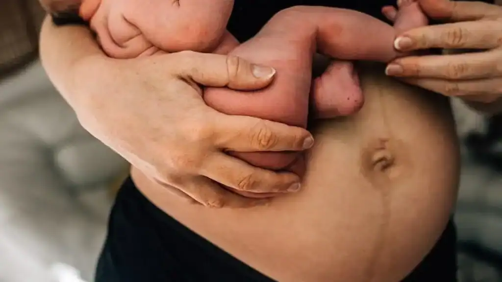 Why Is My Stomach Still Big After Pregnancy Blackpool?