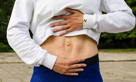 When Could Diastasis Recti Be the Missing Piece of the Puzzle Blackpool?